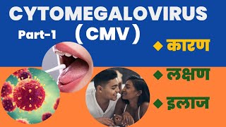 Cytomegalovirus  CMV  Positive l कारण । लक्षण । और इलाज l Part1 [upl. by Lawrence]