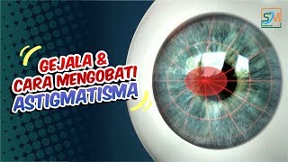 Gejala dan Cara Mengobati Astigmatisma [upl. by Asor]