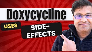 Your guide to Doxycycline uses and side effects [upl. by Anwahsit677]