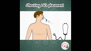 HOW TO CHECK NG TUBE [upl. by Atinahs636]