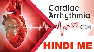 What is Arrhythmias  Tachycardia VS Bradycardia in Hindi  Medical Guruji [upl. by Enahsed605]