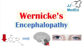 Wernicke’s Encephalopathy  Causes Symptom Triad amp Treatment [upl. by Ainimre]