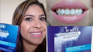 Clareamento dental com as fitas Whitestrips Oral B  esclarecendo dúvidas [upl. by Alleirbag993]