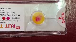 RAPID UREASE TEST FOR H PYLORI  TEST FOR GASTRITIS ULCER hpylori rutkit [upl. by Arni]