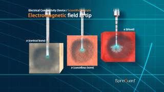 PediGuard Technology Electrical Conductivity Principle [upl. by Jonina623]