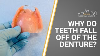 Why do teeth fall off of the denture [upl. by Nnylaf]