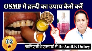 हल्दी से कैसे ठीक करें OSMF को OSMF treatment in India submucous fibrosis [upl. by Eneles743]