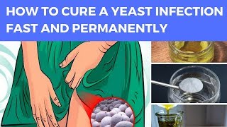 How To Cure A Yeast Infection Fast And Permanently  Yeast Infection Women [upl. by Annayram]