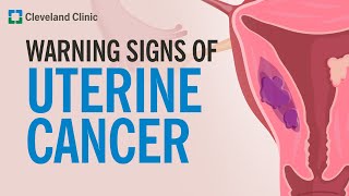 The Most Common Warning Sign of Uterine Cancer [upl. by Duer]