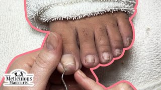 Pedicure Tutorial How to Relieve Pain in Your Toenails [upl. by Guntar]