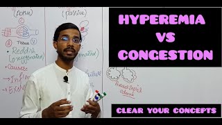 HYPEREMIA VS CONGESTION medicalpathologyhyperemiacongestion [upl. by Suh]