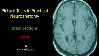 Picture Test in Neuroanatomy Brain Sections 4 [upl. by Shulman377]