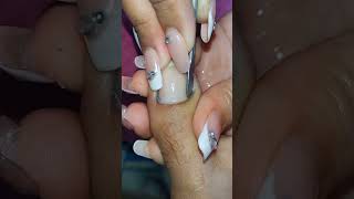 cleaning toenail [upl. by Eal]