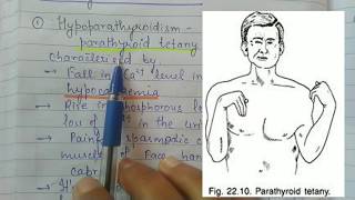 Parathyroid Disorders  Hypoparathyroidism and Hyperparathyroidism [upl. by Melody]