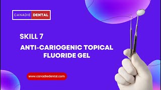 Skill 7Anti Cariogenic Topical Fluoride Gel [upl. by Schram]