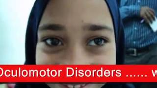 Intermittent Exotropia  الحول الوحشي المتقطع [upl. by Paapanen481]