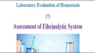 Laboratory Evaluation of Hemostasis 7 Assessment of Fibrinolytic System [upl. by Ahsetra]