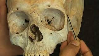 Learn Osteology  Skull bone part 1  MBBS Viva  by Dr Ghanashyam Vaidya [upl. by Ardekan]