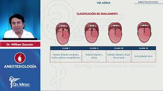 ANESTESIOLOGÍA Vía aérea Test de Mallampati mp4 [upl. by Lazarus]
