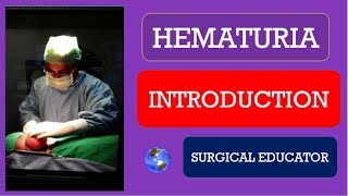 HEMATURIA  INTRODUCTION [upl. by Wendin]