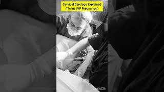 Cervical Cerclage Procedure for twin IVF pregnancy by Dr Rakshita Malik ivf pregnancy twins [upl. by Dunstan]