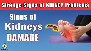 Strange Signs of KIDNEY Problems Renal  Kidney Failure Symptoms [upl. by Gussman335]