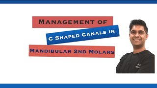 Endodontic Management of Cshape Canals [upl. by Egarton]