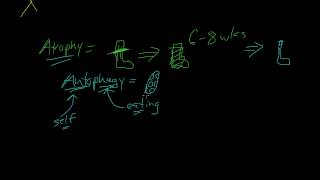 3  Introduction to Pathology  Atrophy Metaplasia [upl. by Innej]