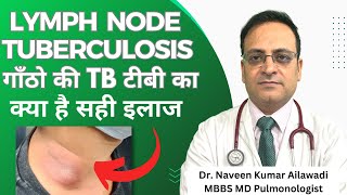 Lymph Node Tuberculosis गाँठो की TB टीबी का क्या है सही इलाज drnaveenailawadi lungdoctor [upl. by Alyaj]