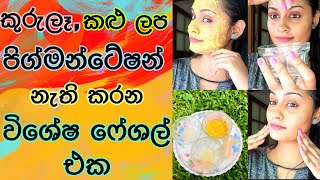 කුරුලෑපිග්මන්ටේෂන්කළු ලප සුව කරන විශේෂ ෆෙෂල් එකDark SpotsPigmentationAcne Brightening facial [upl. by Glass676]