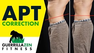 Anterior Pelvic Tilt Before and After [upl. by Tila]