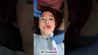 RF Treatment  HIFU Face Lift  HIKO Nose Lift  Microblading  Mesolipo  Lip Tattoo  Chin Filler [upl. by Laenaj556]