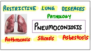 Restrictive Lung Diseases PNEUMOCONIOSIS Anthracosis  Silicosis  Asbestosis pathology robbins [upl. by Ellemaj]