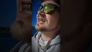 Moissanite Grillz From IceGiant Full Review Video Dropping Soon theigtofficial01 shorts grillz [upl. by Kelcie663]