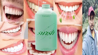 Swish Mouthwash  Honest Review [upl. by Cele222]