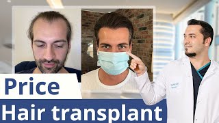 Hair Transplant in Karachi  Amazing Results By AlKhaleej Clinics [upl. by Arahk]