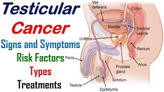 Testicular Cancer  Signs Symptoms Risk Factors Types and Treatments  Cancer Knowledge [upl. by Jamieson]