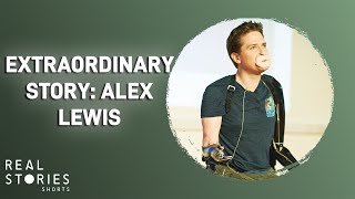 The Extraordinary Case of Alex Lewis short [upl. by Rebe]