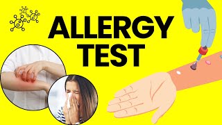 What Is An Allergy Test Procedure Side Effects Precautions amp Reports [upl. by Witty]