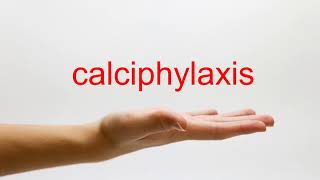 How to Pronounce calciphylaxis  American English [upl. by Garvin849]