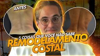 5 COISAS QUE VOCÊ NÃO SABE SOBRE REMODELAMENTO COSTAL [upl. by Lleruj]