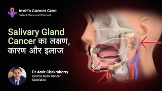 Salivary Gland Cancer  Causes Symptoms amp treatment Explained by Dr Amit Chakraborty [upl. by Stella]