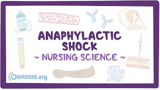 Anaphylactic shock Clinical Nursing Care [upl. by Sarkaria730]