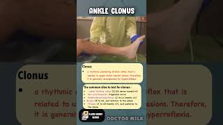 Ankle clonus neetpg usmle [upl. by Edwin]