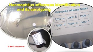 Haemophilus influenzae identification and its serotypes antisera expo [upl. by Aaren]