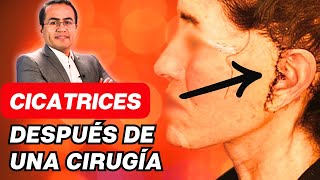 CICATRICEZ de una Cirugía Plástica 🙈 Abordaje Tratamientos complicaciones ✅ Dr Percy Nevado [upl. by Solitta941]