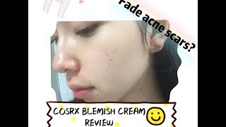 COSRX CENTELLA ASIATICA BLEMISH CREAM REVIEW  FADE ACNE SCARS [upl. by Eimareg]