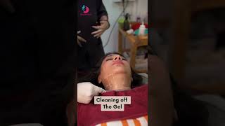 HIFU Treatment  Double Chin Reduction with HIFU  Dr Parul hifutreatment shorts ytshorts [upl. by Amlet]