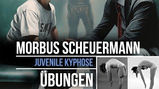 Übungen Morbus Scheuermann  Juvenile Kyphose  Rundrücken [upl. by Accebar]