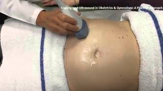 Ultrasound in Obstetrics amp Gynecology A Practical Approach  Clip 104 [upl. by Artinahs]